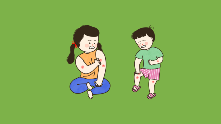 피부 건선 관리 방법이 필요한 아이들